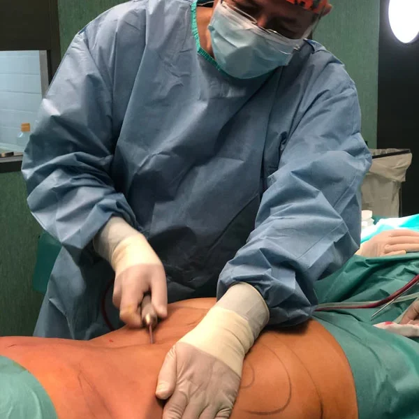 ARAN-liposuccion-3853